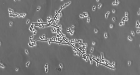 Candidiasis in Birds: Signs, Treatment, and Prevention of Yeast